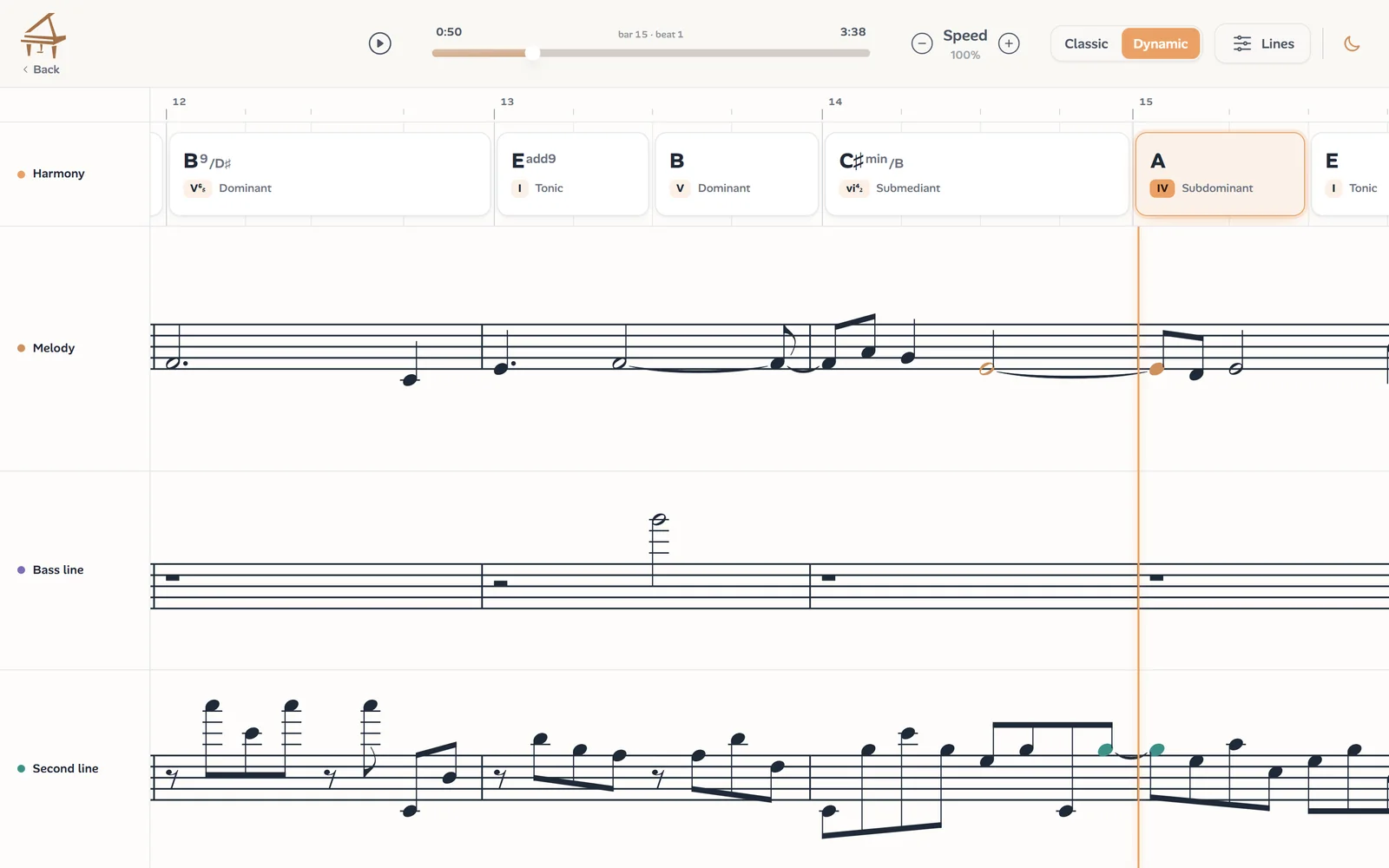 Ivory's Dynamic view: the chords, the melody, the bass line and a second line on one timeline, in time with the recording